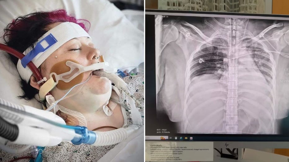 ‘I vaped for one year and almost died'