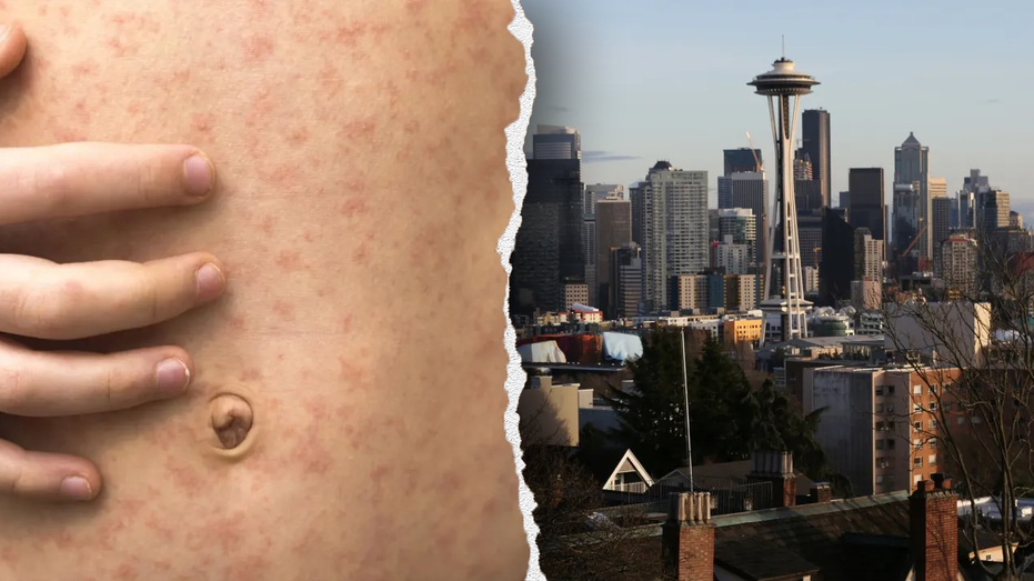 Officials in West Coast state sound alarm after traveler diagnosed with highly contagious viral disease