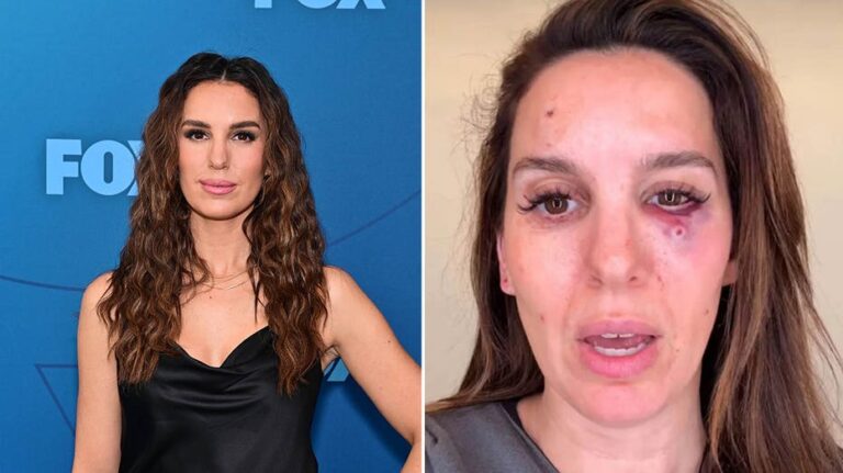 Former Disney star Christy Carlson Romano reveals shocking details about nearly losing her eye