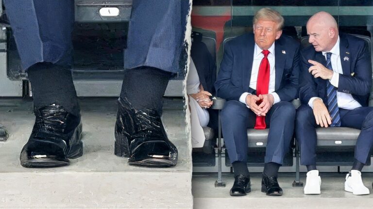 Doctors react to alleged Trump health concerns as photos show swelling and bruising