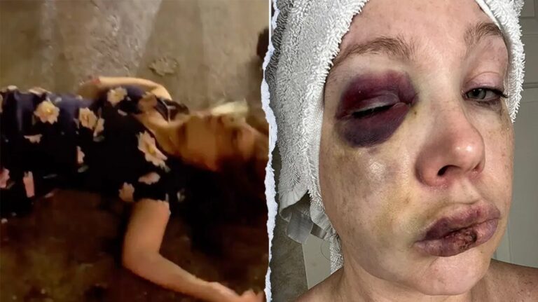 Cincinnati beatdown victim reveals 'very bad brain trauma' in first remarks since viral assault