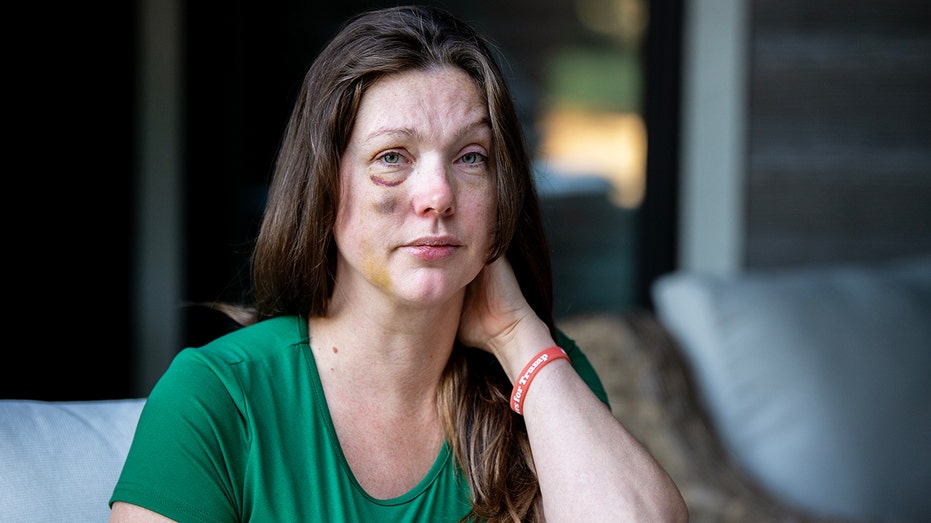Cincinnati viral beating victim says violent mob started attacking 'like a pack of wolves'