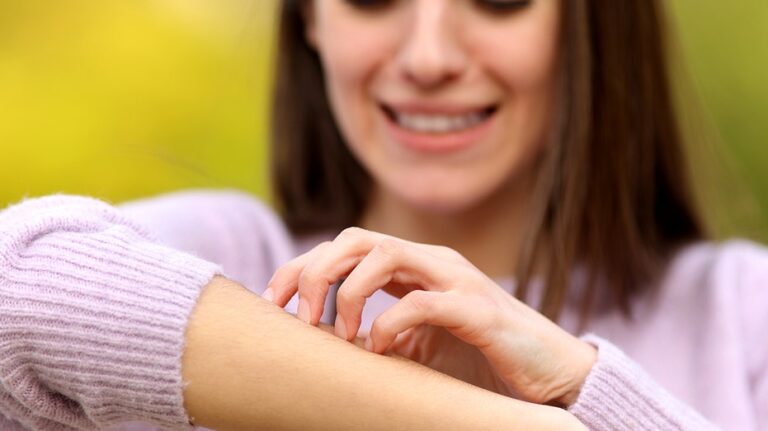 Potentially severe mosquito-borne virus surges in US above normal levels