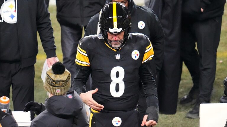 Steelers' Aaron Rodgers bloodied after taking huge hit from Bills defender