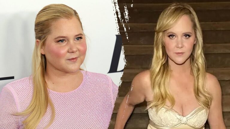 What to know about Cushing’s syndrome, which led to Amy Schumer's dramatic weight loss