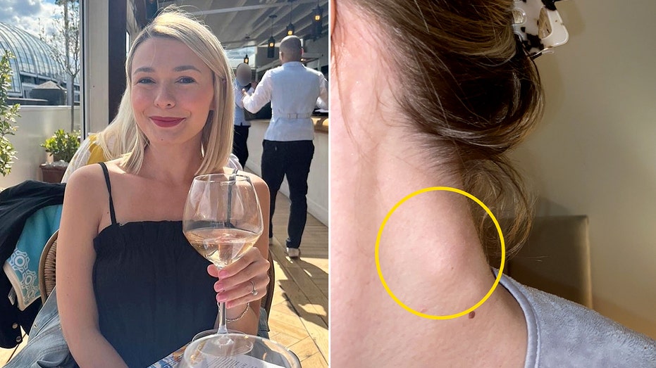 Woman's painful reaction to wine leads to life-changing cancer discovery